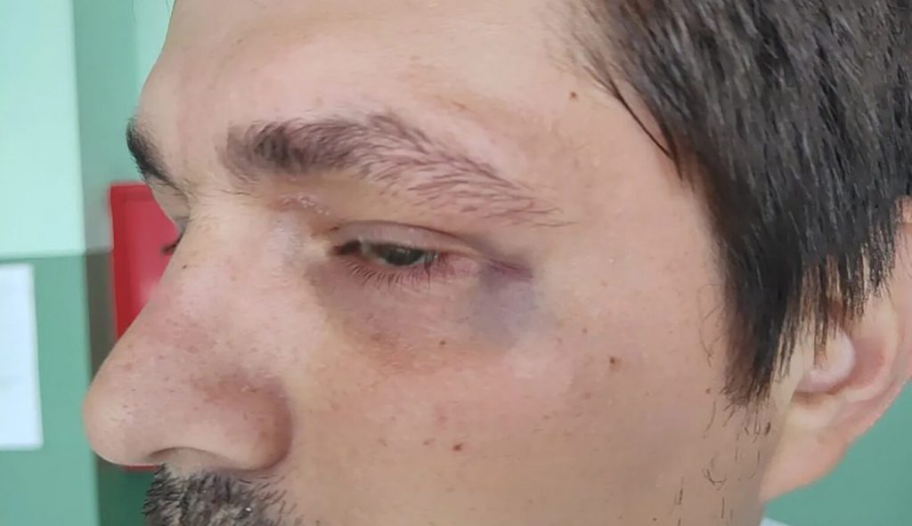 Napadnuti aktivista Aleksa Pavlović