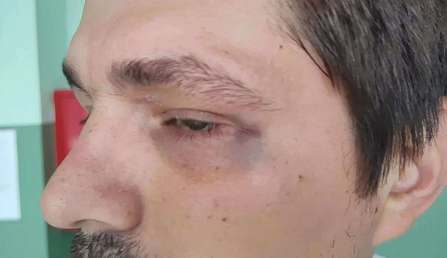 Napadnuti aktivista Aleksa Pavlović