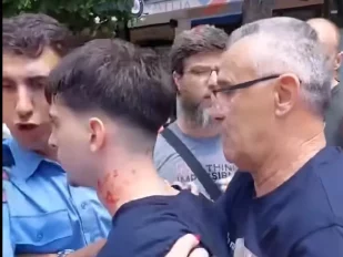 Incidenti u Kosovskoj Mitrovici