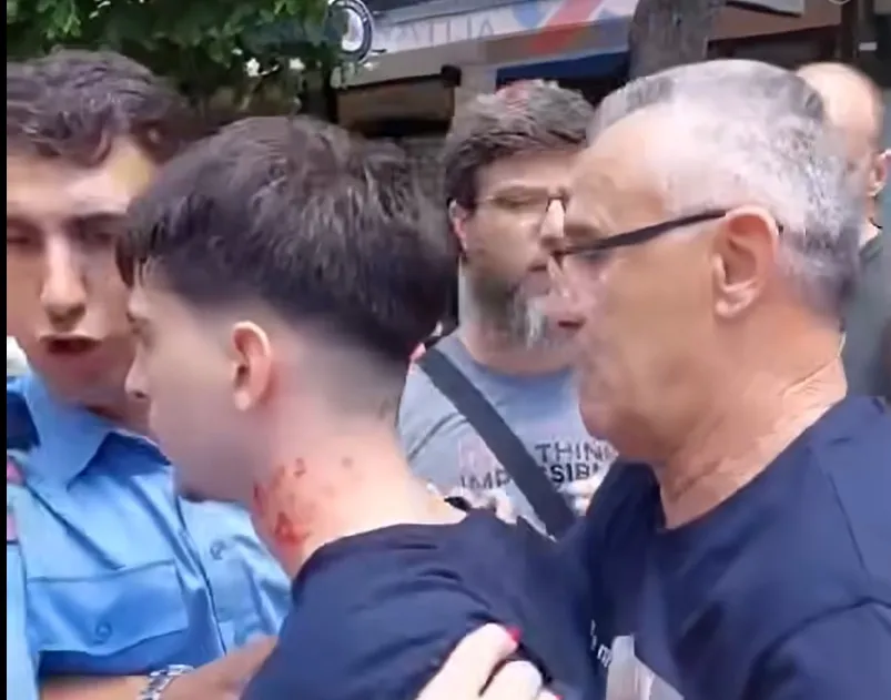 Incidenti u Kosovskoj Mitrovici