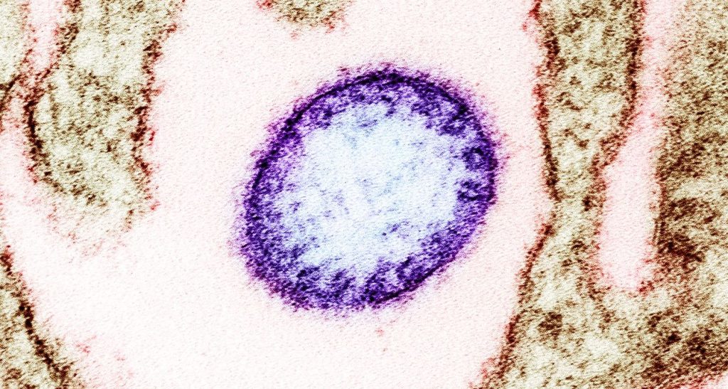 Obojena transmisiona elektronska mikrografija zrele ekstracelularne čestice nipah virusa (ljubičasta) pored periferije zaražene VERO ćelije (smeđa)