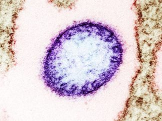 Obojena transmisiona elektronska mikrografija zrele ekstracelularne čestice nipah virusa (ljubičasta) pored periferije zaražene VERO ćelije (smeđa)