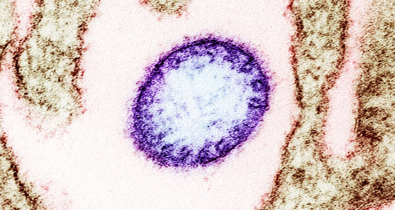 Obojena transmisiona elektronska mikrografija zrele ekstracelularne čestice nipah virusa (ljubičasta) pored periferije zaražene VERO ćelije (smeđa)