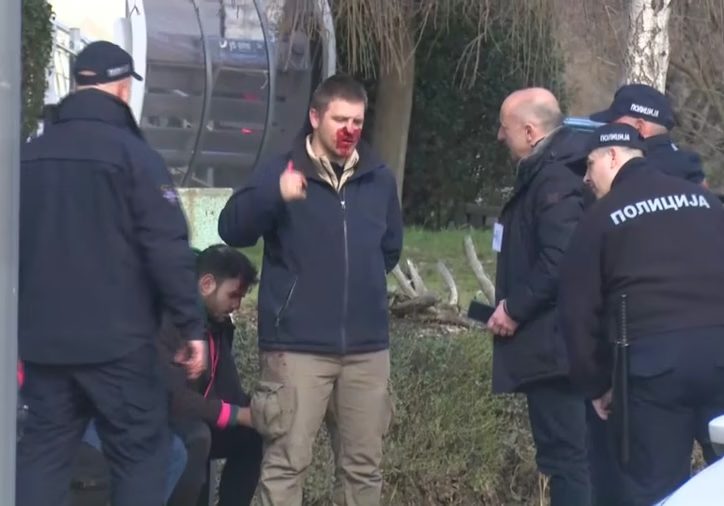 pretučen muškarac u Boru, lokalni izbori