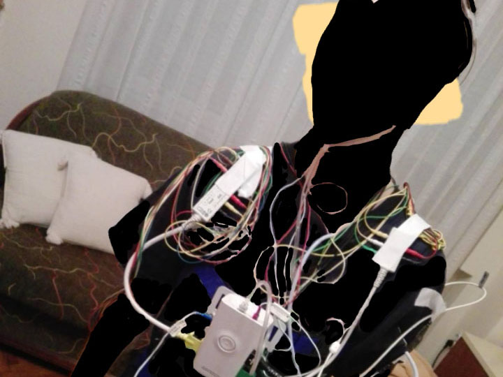 Aparat na telu, bol u duši